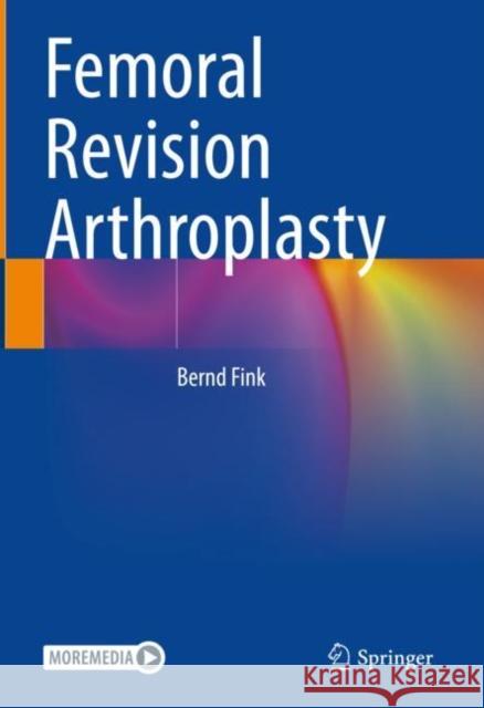 Femoral Revision Arthroplasty Bernd Fink 9783030848200 Springer