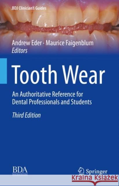 Tooth Wear: An Authoritative Reference for Dental Professionals and Students Andrew Eder Maurice Joseph Faigenblum 9783030861094 Springer