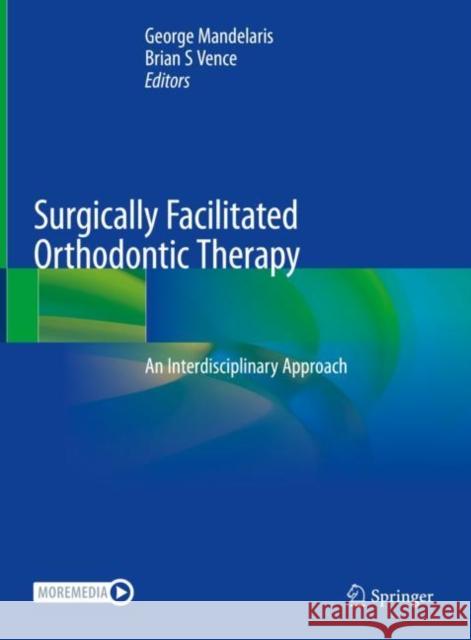 Surgically Facilitated Orthodontic Therapy: An Interdisciplinary Approach George Mandelaris Brian Vence 9783030900984