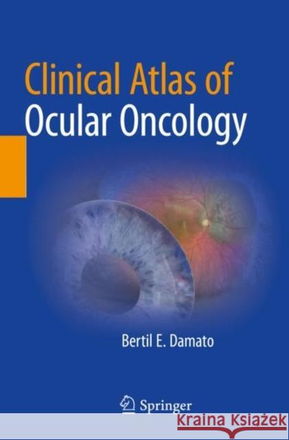 Clinical Atlas of Ocular Oncology Bertil E. Damato 9783030901295