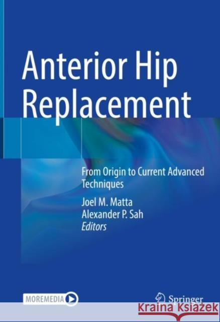 Anterior Hip Replacement: From Origin to Current Advanced Techniques Joel M. Matta Alexander P. Sah  9783030918958 Springer Nature Switzerland AG