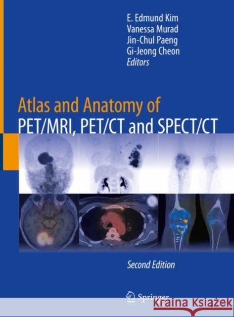 Atlas and Anatomy of Pet/Mri, Pet/CT and Spect/CT Kim, E. Edmund 9783030923488 Springer International Publishing