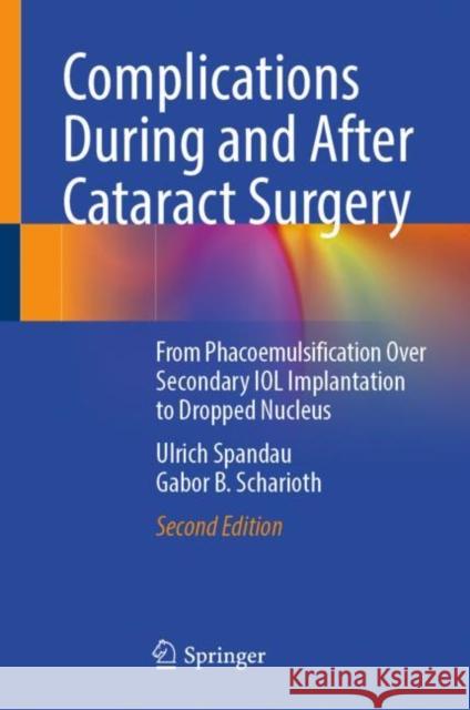 Complications During and After Cataract Surgery: From Phacoemulsification Over Secondary Iol Implantation to Dropped Nucleus Spandau, Ulrich 9783030935306 Springer International Publishing