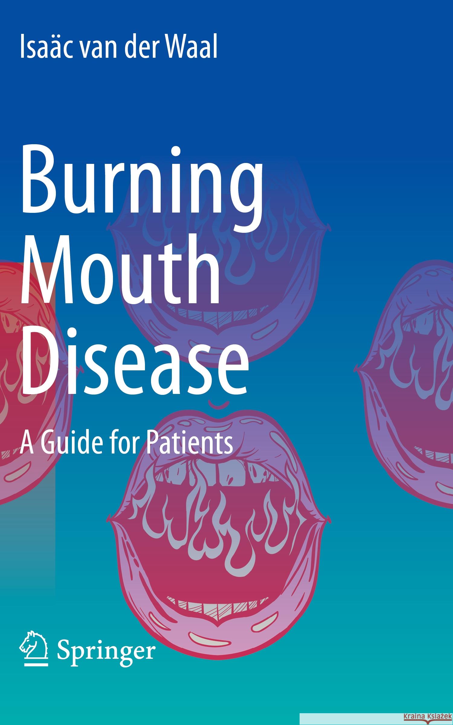 Burning Mouth Disease van der Waal, Isaäc 9783030942281 Springer International Publishing