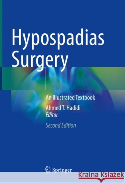 Hypospadias Surgery: An Illustrated Textbook Hadidi, Ahmed T. 9783030942472 Springer Nature Switzerland AG