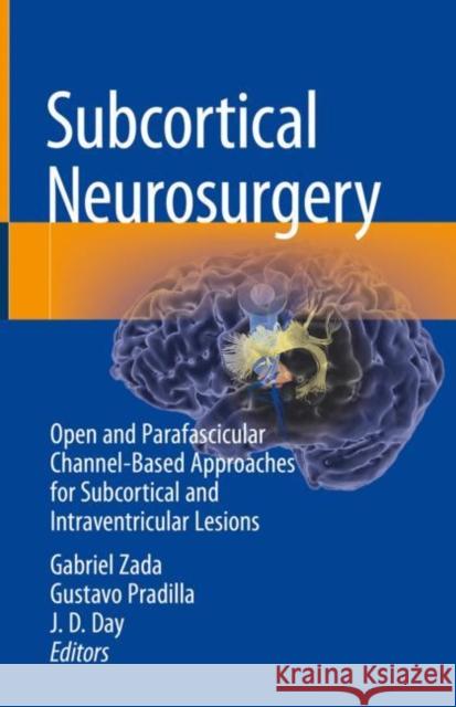 Subcortical Neurosurgery: Open and Parafascicular Channel-Based Approaches for Subcortical and Intraventricular Lesions Gabriel Zada Gustavo Pradilla J. D. Day 9783030951528 Springer Nature Switzerland AG