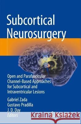 Subcortical Neurosurgery  9783030951559 Springer International Publishing