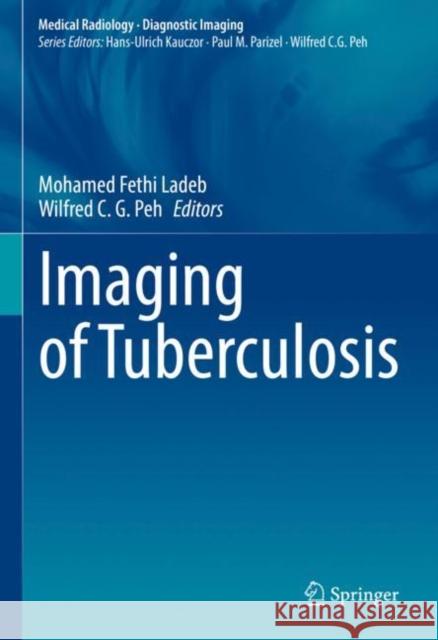 Imaging of Tuberculosis  9783031070396 Springer International Publishing