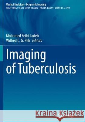 Imaging of Tuberculosis  9783031070426 Springer International Publishing