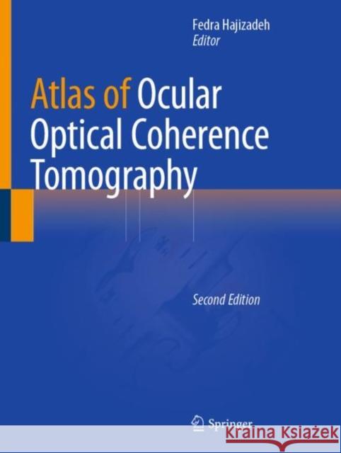 Atlas of Ocular Optical Coherence Tomography Fedra Hajizadeh 9783031074097 Springer