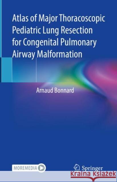Atlas of Major Thoracoscopic Pediatric Lung Resection for Congenital Pulmonary Airway Malformation Arnaud Bonnard 9783031079368 Springer