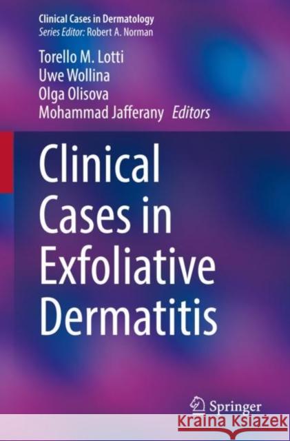 Clinical Cases in Exfoliative Dermatitis  9783031084652 Springer International Publishing