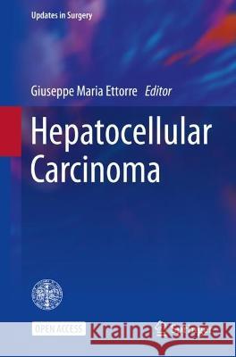 Hepatocellular Carcinoma Giuseppe Maria Ettorre 9783031093708