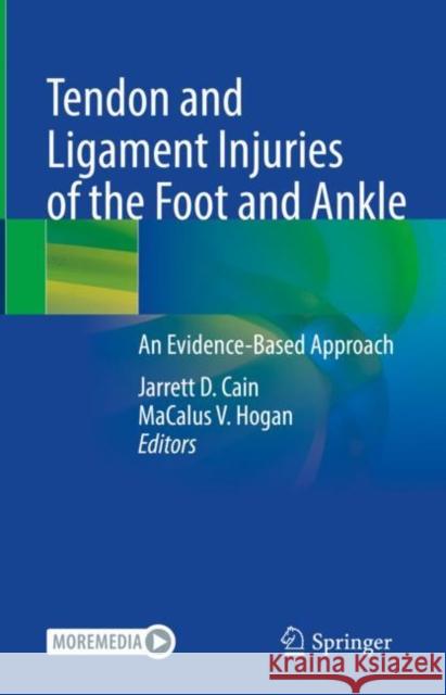 Tendon and Ligament Injuries of the Foot and Ankle: An Evidence-Based Approach Jarrett D. Cain MaCalus V. Hogan  9783031104893 Springer International Publishing AG