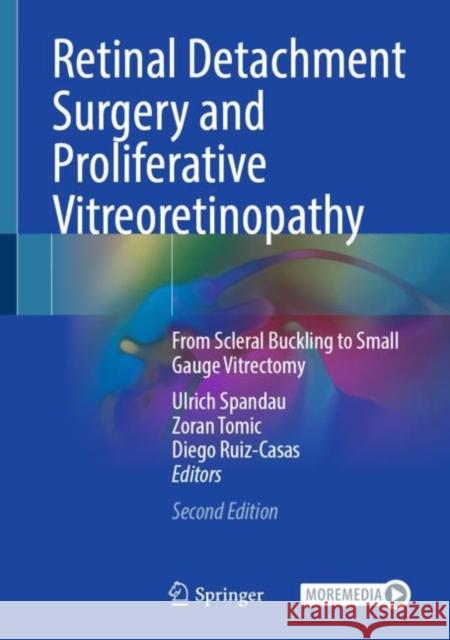 Retinal Detachment Surgery and Proliferative Vitreoretinopathy: From Scleral Buckling to Small Gauge Vitrectomy Ulrich Spandau Zoran Tomic Diego Ruiz-Casas 9783031119453 Springer