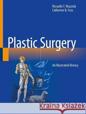 Plastic Surgery: An Illustrated History Riccardo F. Mazzola Catherine B. Foss 9783031120022