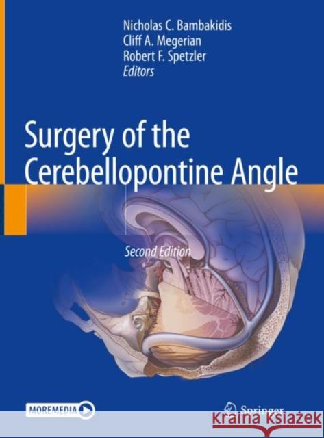 Surgery of the Cerebellopontine Angle  9783031125065 Springer International Publishing AG