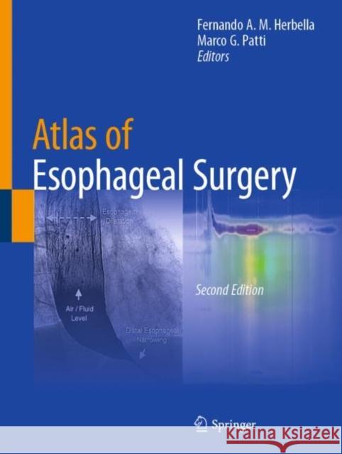 Atlas of Esophageal Surgery Fernando A. M. Herbella Marco G. Patti 9783031127892 Springer