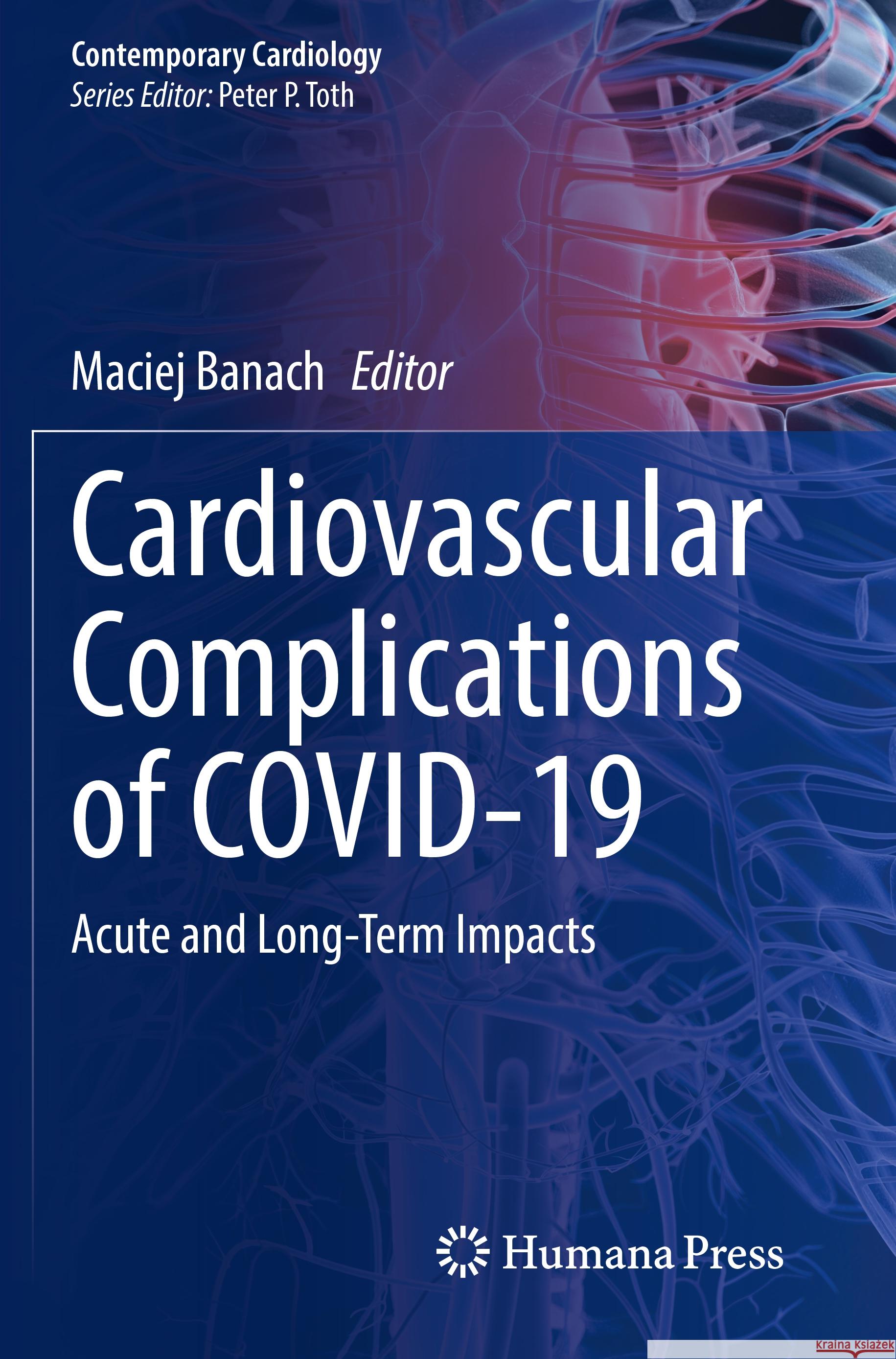 Cardiovascular Complications of Covid-19: Acute and Long-Term Impacts Maciej Banach 9783031154805 Humana