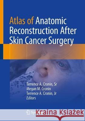 Atlas of Anatomic Reconstruction After Skin Cancer Surgery Terrence A. Croni Megan M. Cronin Terrence A. Croni 9783031158773 Springer