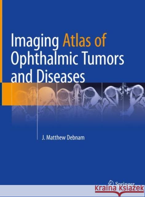 Imaging Atlas of Ophthalmic Tumors and Diseases J. Matthew Debnam 9783031174780