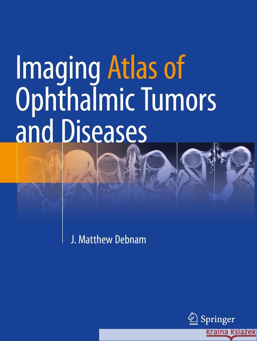 Imaging Atlas of Ophthalmic Tumors and Diseases J. Matthew Debnam 9783031174810