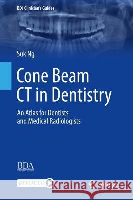 Cone Beam CT in Dentistry: An Atlas for Dentists and Medical Radiologists Suk Ng 9783031254796 Springer
