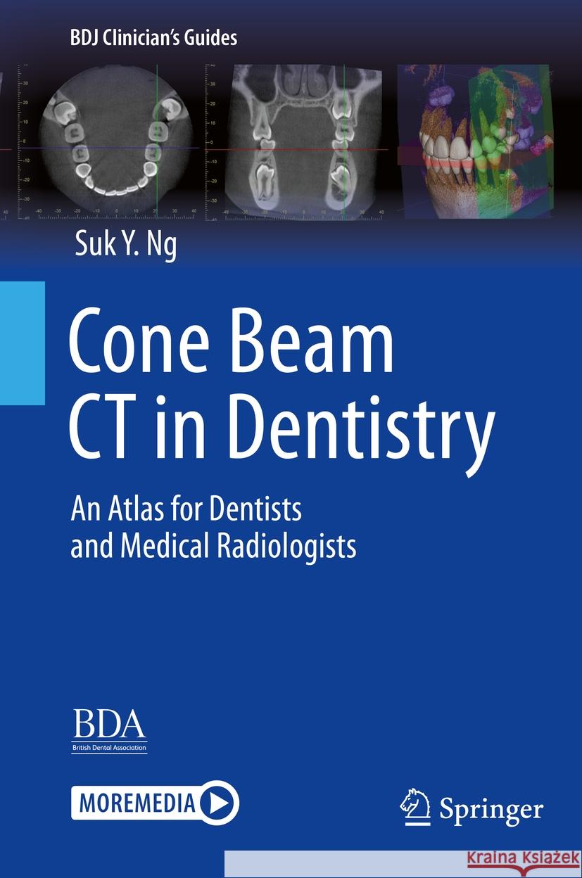 Cone Beam CT in Dentistry Suk Y. Ng 9783031254826 Springer International Publishing