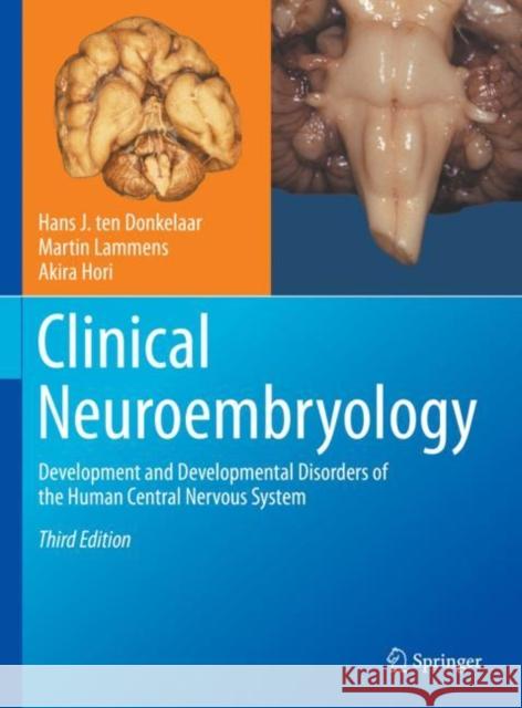Clinical Neuroembryology: Development and Developmental Disorders of the Human Central Nervous System Hans J. Te Martin Lammens Akira Hori 9783031260971 Springer