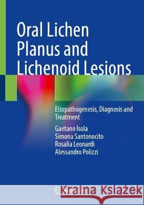 Oral Lichen Planus and Lichenoid Lesions: Etiopathogenesis, Diagnosis and Treatment Gaetano Isola Simona Santonocito Rosalia Leonardi 9783031297649