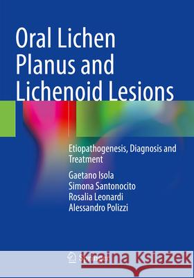 Oral Lichen Planus and Lichenoid Lesions Isola, Gaetano, Simona Santonocito, Rosalia Leonardi 9783031297670