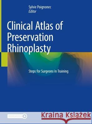 Clinical Atlas of Preservation Rhinoplasty: Steps for Surgeons in Training Sylvie Poignonec 9783031299766 Springer