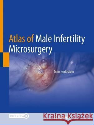 Atlas of Male Infertility Microsurgery Marc Goldstein 9783031316005 Springer