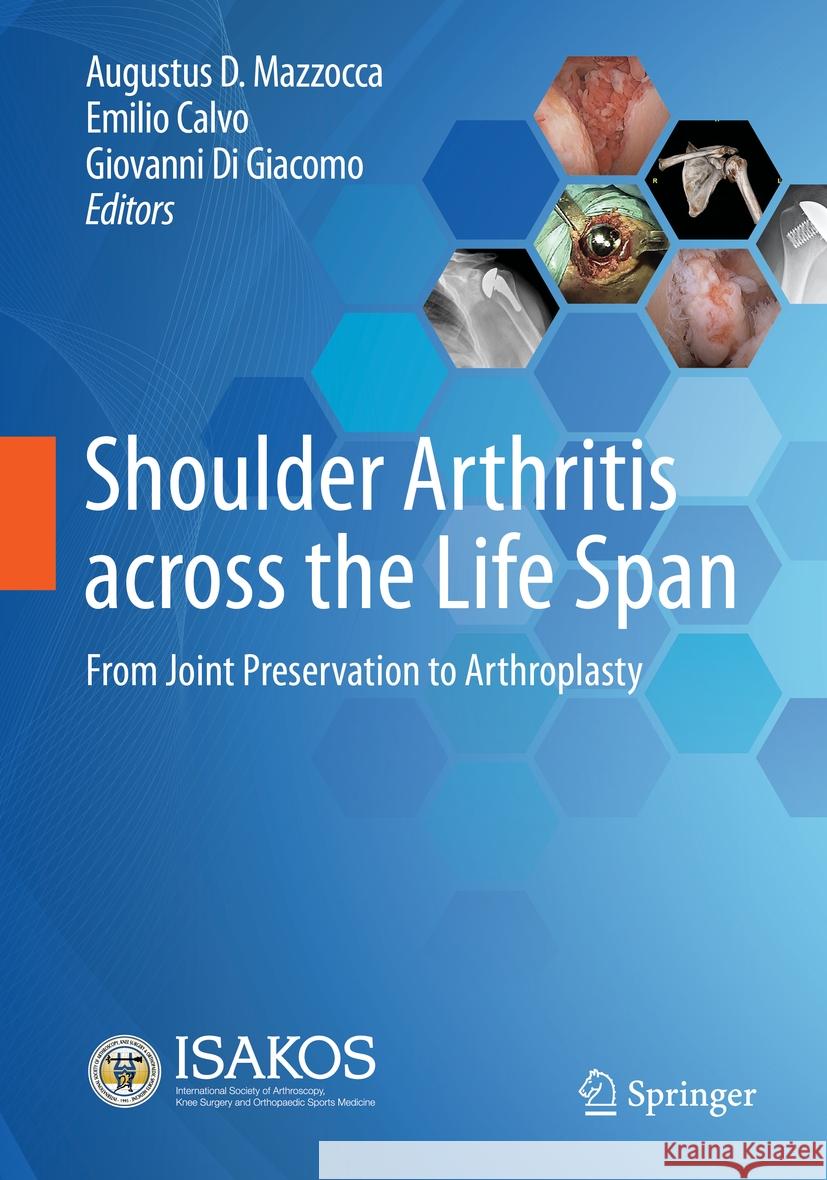 Shoulder Arthritis across the Life Span  9783031333002 Springer International Publishing