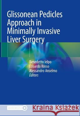 Glissonean Pedicles Approach in Minimally Invasive Liver Surgery Benedetto Ielpo Edoardo Rosso Alessandro Anselmo 9783031352942 Springer