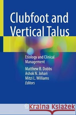 Clubfoot and Vertical Talus  9783031358852 Springer International Publishing