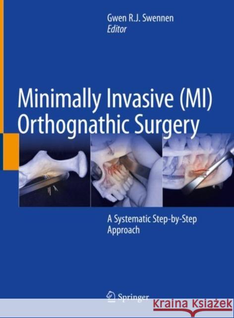 Minimally Invasive (MI) Orthognathic Surgery  9783031380112 Springer International Publishing AG