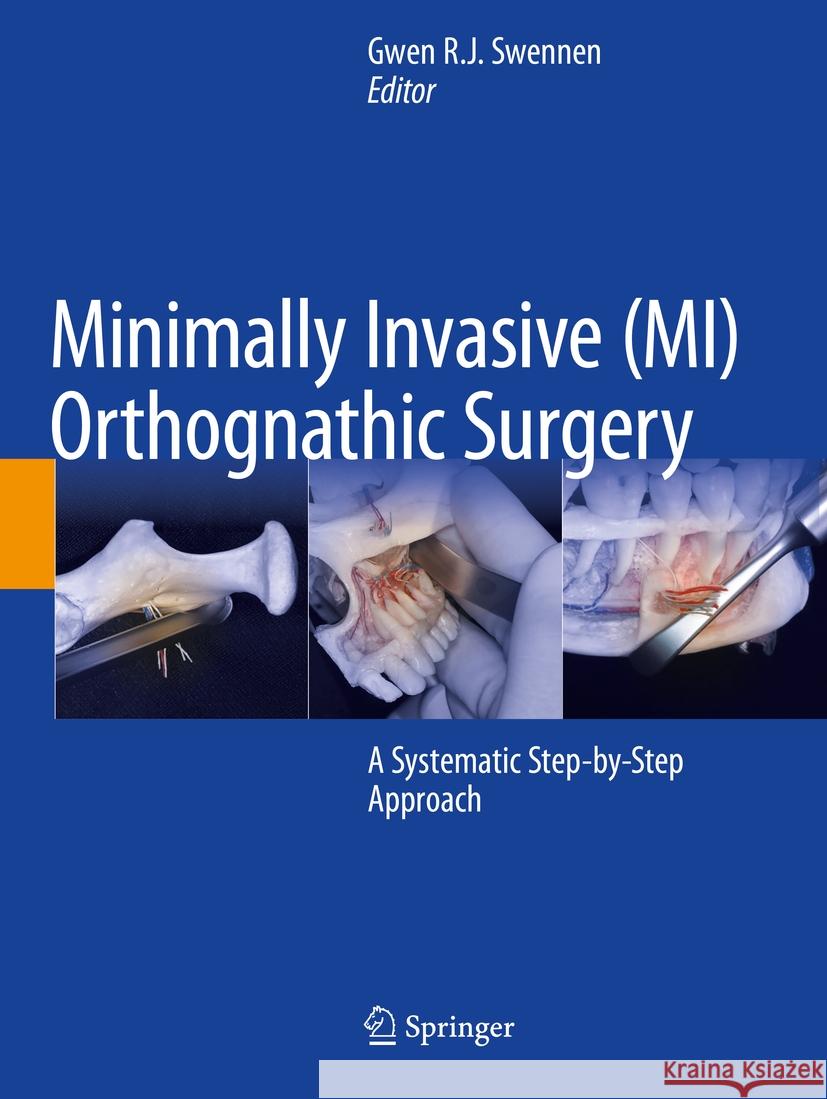 Minimally Invasive (MI) Orthognathic Surgery: A Systematic Step-by-Step Approach Gwen R.J. Swennen 9783031380143 Springer International Publishing AG