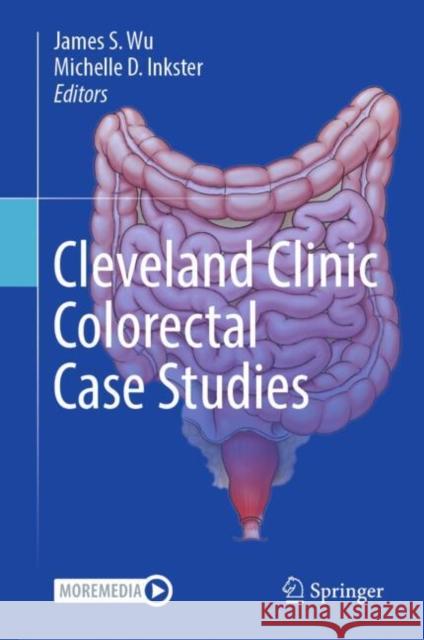 Cleveland Clinic Colorectal Case Studies  9783031398797 Springer International Publishing AG