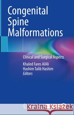Congenital Spine Malformations  9783031590306 Springer Nature Switzerland