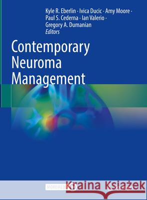 Contemporary Neuroma Management Kyle R. Eberlin Ivica Ducic Amy Moore 9783031597572 Springer