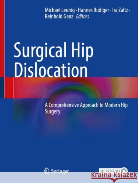 Surgical Hip Dislocation: A Comprehensive Approach to Modern Hip Surgery  9783031706219 Springer International Publishing AG