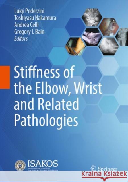Stiffness of the Elbow, Wrist and Related Pathologies Luigi Pederzini Toshiyasu Nakamura Andrea Celli 9783031813801 Springer
