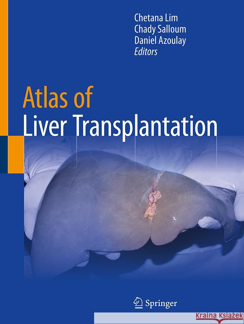 Atlas of Liver Transplantation Chetana Lim Chady Salloum Daniel Azoulay 9783031852633 Springer