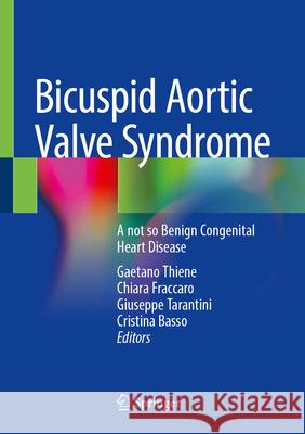 Bicuspid Aortic Valve Syndrome: A not so Benign Congenital Heart Disease Gaetano Thiene, Chiara Fraccaro, Giuseppe Tarantini 9783031855887 Springer International Publishing AG