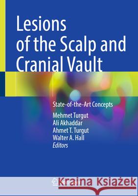 Lesions of the Scalp and Cranial Vault: State-Of-The-Art Concepts Mehmet Turgut Ali Akhaddar Ahmet T. Turgut 9783031882432