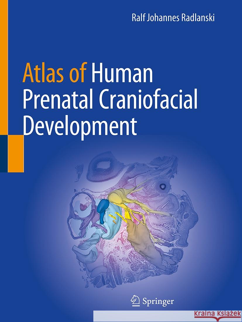 Atlas of Human Prenatal Craniofacial Development Ralf Johannes Radlanski 9783031888113 Springer