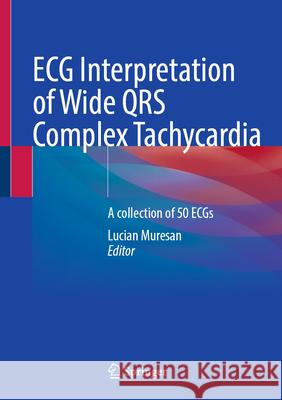 ECG Interpretation of Wide Qrs Complex Tachycardia: A Collection of 50 Ecgs Lucian Muresan 9783031970290 Springer