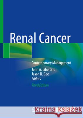 Renal Cancer: Contemporary Management John Libertino Jason Gee 9783031975981 Springer