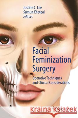 Facial Feminization Surgery: Operative Techniques and Clinical Considerations Justine C. Lee Sumun Khetpal 9783032007506 Springer